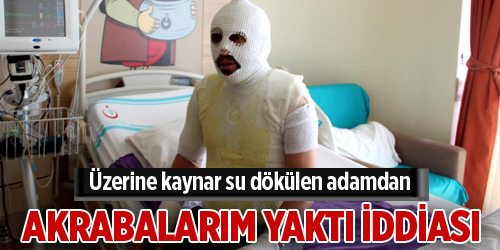 Akrabaları tarafından kaynar suyla yakıldığını iddia etti