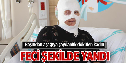 Başından aşağıya çaydanlık dökülen kadın feci şekilde yandı